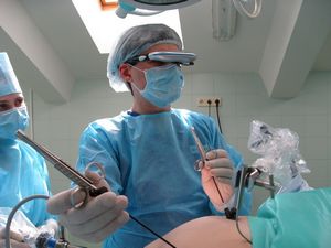 Лапароскопия матки при лечении бесплодия у женщин
