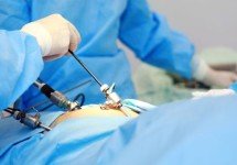 diagnosticheskaya-laparoscopiya